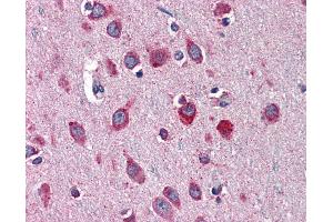 Immunohistochemistry (IHC) image for anti-serpin Peptidase Inhibitor, Clade I (neuroserpin), Member 1 (SERPINI1) (AA 17-411) antibody (ABIN790558)
