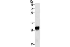 Gel: 8 % SDS-PAGE, Lysate: 50 μg, Lane: Human liver cancer tissue, Primary antibody: ABIN7129664(GSTO1 Antibody) at dilution 1/200, Secondary antibody: Goat anti rabbit IgG at 1/8000 dilution, Exposure time: 20 seconds (GSTO1 抗体)
