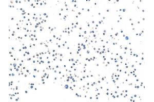 Immunocytochemistry (ICC) image for anti-CD28 (CD28) (AA 170-220) antibody (ABIN7455122) (Recombinant CD28 抗体  (AA 170-220))