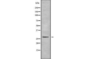 Western blot analysis of PEX11A using LOVO whole cell lysates (PEX11A 抗体  (Internal Region))