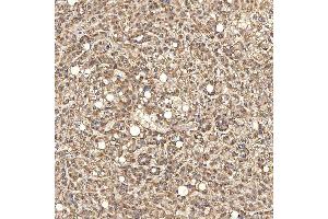 IHC analysis of Syntenin 2/SDCBP2 using anti-Syntenin 2/SDCBP2 antibody (ABIN7600017).