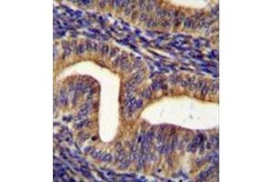 Immunohistochemistry analysis in formalin fixed and paraffin embedded human uterus tissue reacted with Ghrelin receptor / GHSR Antibody (C-term) followed by peroxidase conjugation of the secondary antibody and DAB staining. (GHSR 抗体  (C-Term))