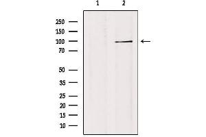 Western blot analysis of extracts from 293, using TF3C3 Antibody. (GTF3C3 抗体)
