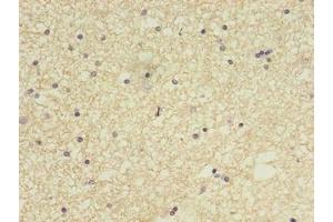 Immunohistochemistry of paraffin-embedded human brain tissue using ABIN7148084 at dilution of 1:100 (CCDC134 抗体  (AA 23-229))