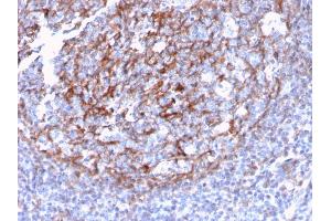 Formalin-fixed, paraffin-embedded human Tonsil Dendritic stained with CD21 / CR2 Recombinant Rabbit Monoclonal Antibody (CR2/3124R). (Recombinant CD21 抗体  (AA 142-240))