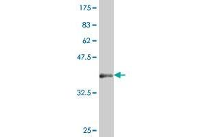 Western Blot detection against Immunogen (37. (HHEX 抗体  (AA 133-237))
