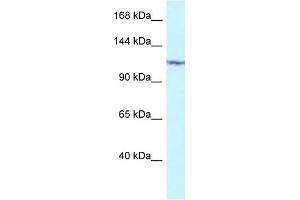 WB Suggested Anti-PKN2 Antibody Titration: 1. (PKN2 抗体  (C-Term))