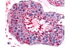 Anti-BEST2 / Bestrophin-2 antibody IHC of human testis. (Bestrophin 2 抗体  (Internal Region))