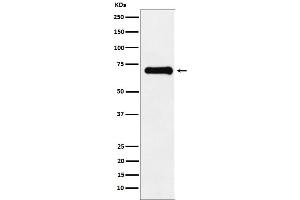 Western blot analysis of Phospho-PAK4 + PAK5 + PAK6 (S474 + S560 + S602) expression in U87-MG cell lysate.
