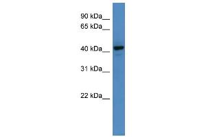 WB Suggested Anti-RNF128  Antibody Titration: 0. (RNF128 抗体  (C-Term))