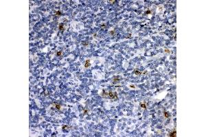 IHC analysis of Cathepsin G/CTSG using anti-Cathepsin G/CTSG antibody (ABIN4886550).