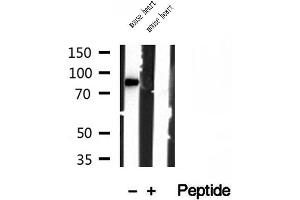 Western blot analysis of extracts of mouse heart tissue, using YME1L1 antibody. (YME1L1 抗体  (C-Term))