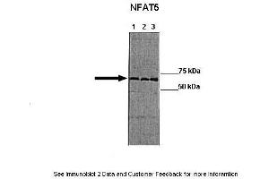 Lanes: Lane 1:241 µg HT 29 lysate blocked with 5 % FBS Lane 2: 041 µg HT 29 lysate blocked with no FBS Lane 3: 041 µg HT-29 lyaste blocked with no PBS + 100 mM NaCl Primary Antibody Dilution: 1:0000Secondary Antibody: Goat anti-rabbit-HRP Secondary Antibody Dilution: 1:0000  Gene Name: NFAT5 Submitted by: Manuel Fresno, CBMSO