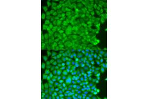 Immunofluorescence analysis of HeLa cells using SGCE antibody (ABIN5973070). (SGCE 抗体)
