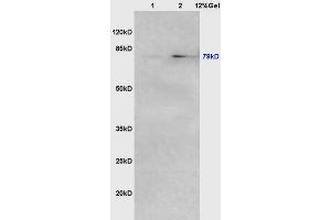Lane 1: mouse lung lysates Lane 2: mouse intestine lysates probed with Anti VG5Q/AGGF1 Polyclonal Antibody, Unconjugated (ABIN722380) at 1:200 in 4 °C.