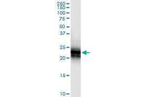 TNFRSF17 (Human) IP-WB Antibody Pair