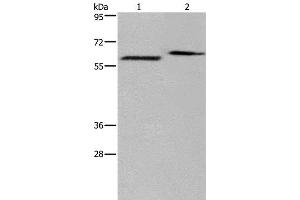 Western Blot analysis of Human fetal brain and Mouse brain tissue using EGR4 Polyclonal Antibody at dilution of 1:400 (EGR4 抗体)