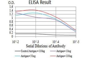 Black line: Control Antigen (100 ng), Purple line: Antigen(10 ng), Blue line: Antigen (50 ng), Red line: Antigen (100 ng), (Cytokeratin 5 抗体  (AA 258-357))