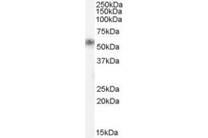 Western Blotting (WB) image for anti-Family with Sequence Similarity 181, Member B (FAM181B) (N-Term) antibody (ABIN2791534) (FAM181B 抗体  (N-Term))