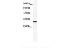 Image no. 1 for anti-Annexin A5 (ANXA5) (AA 71-120) antibody (ABIN202233) (Annexin V 抗体  (AA 71-120))