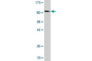Western Blot detection against Immunogen (94. (TRMT2A 抗体  (AA 1-625))
