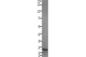 Gel: 10+12 % SDS-PAGE, Lysate: 30 μg, Lane: Human liver cancer tissue, Primary antibody: ABIN7192693(STMN2/STMN3/STMN4 Antibody) at dilution 1/450, Secondary antibody: Goat anti rabbit IgG at 1/8000 dilution, Exposure time: 1 minute (STMN2/STMN3/STMN4 抗体)