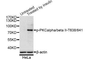 Western blot analysis of extracts of HeLa cells, using Phospho-PRKCB-T641 antibody (ABIN2987563) at 1/1000 dilution.