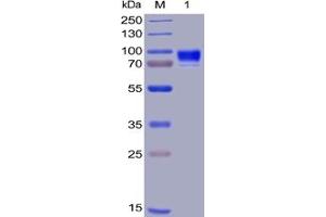 Human CD123, hFc-His Tag on SDS-PAGE under reducing condition. (IL3RA Protein (Fc-His Tag))