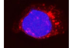 IF analysis of Integrin beta 5/ITGB5 using anti-Integrin beta 5/ITGB5 antibody (ABIN7601320).