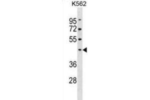 Western Blotting (WB) image for anti-Pellino E3 Ubiquitin Protein Ligase 1 (PELI1) antibody (ABIN3000532) (Pellino 1 抗体)