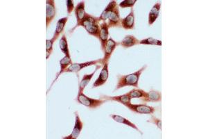 Anti-Hsc70 antibody, ICC ICC: HELA Cell (Hsc70 抗体  (N-Term))