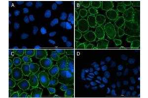Immunofluorescence Microscopy of Rabbit anti-ZO-1 antibody. (TJP1 抗体)