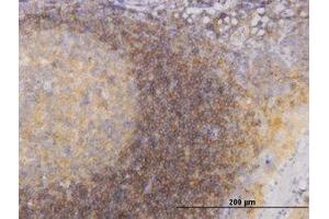 Image no. 3 for anti-Phosphoinositide 3-kinase Regulatory Subunit 4 (PIK3R4) (AA 1259-1359) antibody (ABIN599234) (PIK3R4 抗体  (AA 1259-1359))