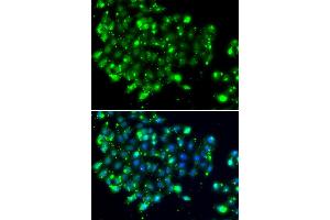 Immunofluorescence analysis of MCF-7 cells using NAT9 antibody (ABIN5974337). (NAT9 抗体)