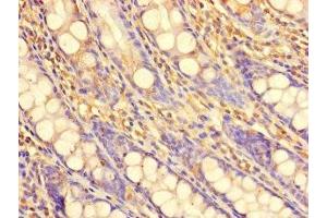 Immunohistochemistry of paraffin-embedded human colon tissue using ABIN7169137 at dilution of 1:100 (PDIK1L 抗体  (AA 1-341))