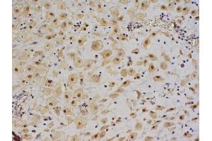 Formalin-fixed and paraffin embedded human pancreas labeled with Anti-IGF II/IGF2 Polyclonal Antibody, Unconjugated (ABIN723620), followed by conjugation to the secondary antibody and DAB staining (IGF2 抗体  (AA 25-51))