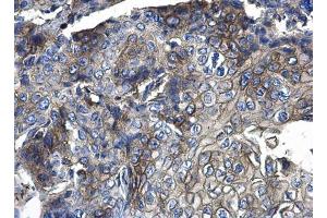 Immunohistochemistry (IHC) image for anti-CD44 (CD44) antibody (ABIN2855292)