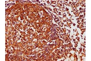 IHC image of ABIN7146858 diluted at 1:1000 and staining in paraffin-embedded human lymph node tissue performed on a Leica BondTM system. (Casein Kinase 1 delta 抗体  (Isoform delta))