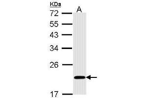 WB Image Sample (30 ug of whole cell lysate) A: A431 , 12% SDS PAGE antibody diluted at 1:1000 (BID 抗体)