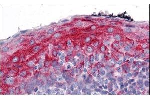 Immunohistochemistry (Paraffin-embedded Sections) (IHC (p)) image for anti-Zinc Finger, MYM-Type 4 (ZMYM4) (C-Term) antibody (ABIN1450014)