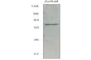 Western Blotting (WB) image for anti-Interferon Regulatory Factor 7 (IRF7) (AA 1-150), (N-Term) antibody (ABIN263914) (IRF7 抗体  (N-Term))