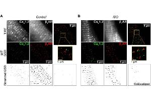 TIRF images (top row), super-resolution GSD localization maps (middle row) and binarized images (bottom row) of immunostained CaV1.