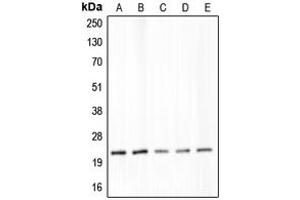 Western blot analysis of Claudin 4 expression in DLD (A), SW480 (B), LS1034 (C), MIA (D), PaCa2 (E) whole cell lysates.