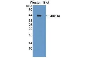 Detection of Recombinant CHL1, Human using Polyclonal Antibody to Cell Adhesion Molecule With Homology To L1CAM (CHL1) (CHL1 抗体  (AA 35-328))