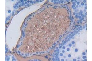 Immunohistochemistry (IHC) image for anti-Albumin (ALB) antibody (ABIN7429667)