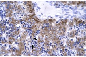 Immunohistochemistry (IHC) image for anti-Excision Repair Cross-Complementing Rodent Repair Deficiency, Complementation Group 8 (ERCC8) (C-Term) antibody (ABIN2777347)