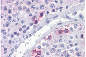 Human Testis: Formalin-Fixed, Paraffin-Embedded (FFPE) (DAZ1 抗体  (AA 21-121))