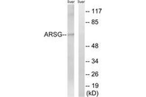 Western blot analysis of extracts from mouse liver cells, using ARSG Antibody. (ARSG 抗体  (AA 251-300))
