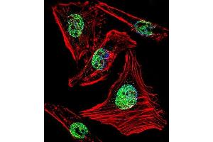 Fluorescent confocal image of Hela cell stained with ZBTB7B Antibody (C-term) (ABIN1882155 and ABIN2840762). (ZBTB7B 抗体  (C-Term))