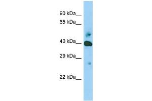 Host: Rabbit Target Name: SHF Sample Type: Jurkat Whole Cell lysates Antibody Dilution: 1. (SHF 抗体  (Middle Region))